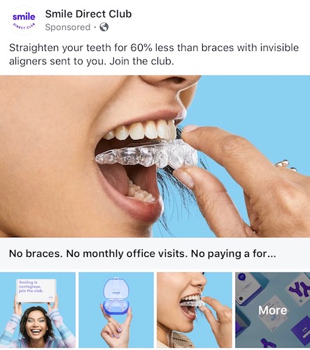 Collection Facebook Smile Direct Club