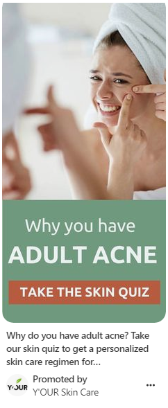 suggerimenti per la generazione di lead Pinterest